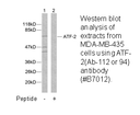 Product image for ATF2 (Ab-112 or 94) Antibody