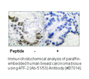 Product image for ATF2 (Ab-69 or 51) Antibody