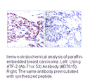 Product image for ATF2 (Ab-71 or 53) Antibody