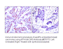 Product image for ATF4 (Ab-245) Antibody