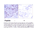 Product image for GATA1 (Ab-142) Antibody