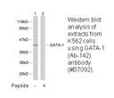 Product image for GATA1 (Ab-142) Antibody