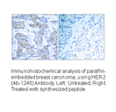 Product image for HER2 (Ab-1248) Antibody