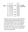 Product image for HER2 (Ab-1248) Antibody
