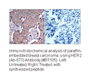 Product image for HER2 (Ab-877) Antibody