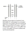 Product image for HER2 (Ab-877) Antibody