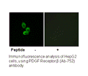 Product image for PDGF Receptor &beta; (Ab-752) Antibody