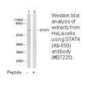 Product image for STAT4 (Ab-693) Antibody