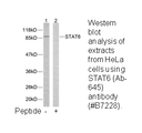 Product image for STAT6 (Ab-645) Antibody