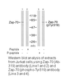 Product image for ZAP-70 (Ab-319) Antibody