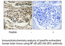 Product image for NF-&kappa;B p65 (Ab-281) Antibody