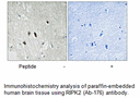 Product image for RIPK2 (Ab-176) Antibody