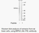 Product image for RIPK2 (Ab-176) Antibody