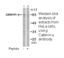 Product image for Catenin-&gamma; Antibody