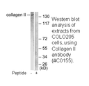 Product image for Collagen II Antibody