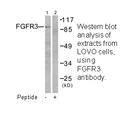 Product image for FGFR3 Antibody