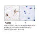 Product image for GABA-B Receptor Antibody