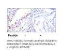 Product image for Ki67 Antibody