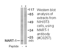 Product image for MART-1 Antibody