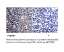 Product image for PML Antibody