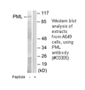 Product image for PML Antibody