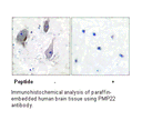 Product image for PMP22 Antibody