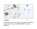 Product image for RASH/RASK Antibody