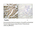 Product image for Sodium Channel-pan Antibody