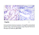 Product image for Thyroid Hormone Receptor &beta; Antibody