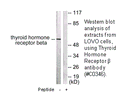 Product image for Thyroid Hormone Receptor &beta; Antibody