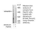 Product image for Vimentin Antibody