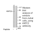Product image for KNTC2 Antibody