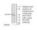 Product image for ZIC1/2/3 Antibody