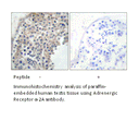 Product image for Adrenergic Receptor &alpha;-2A Antibody