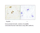 Product image for UBF1 Antibody