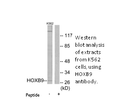 Product image for HOXB9 Antibody