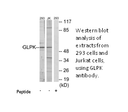 Product image for GLPK Antibody