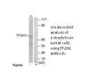 Product image for TF2H1 Antibody