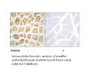 Product image for Actinin &alpha;-2/3 Antibody