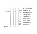Product image for Actinin &alpha;-2/3 Antibody