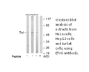 Product image for ETV6 Antibody