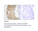 Product image for FRK Antibody
