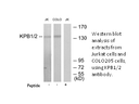 Product image for KPB1/2 Antibody