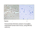 Product image for BRCA2 Antibody