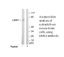 Product image for LIMK1 Antibody