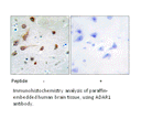Product image for ADAR1 Antibody