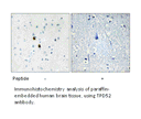 Product image for IPKA Antibody