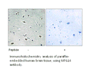 Product image for MTG16 Antibody