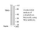 Product image for TBX2 Antibody