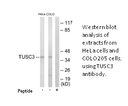 Product image for TUSC3 Antibody
